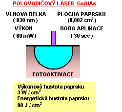 otevt obrzek v novm okn: Laser