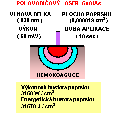 otevt obrzek v novm okn: Laser