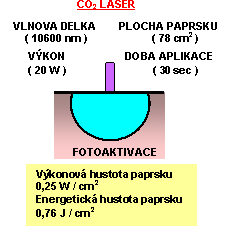 otevt obrzek v novm okn: Laser