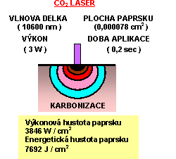 otevt obrzek v novm okn: Laser