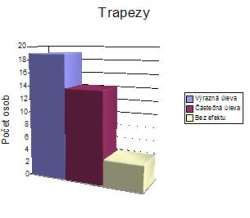 otevt obrzek v novm okn: Trapezy